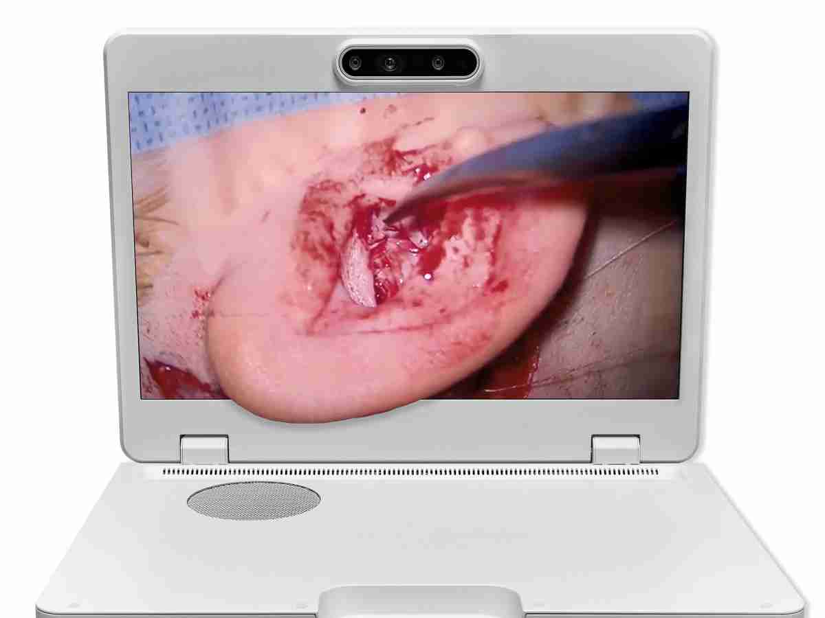 达擎之＂Heads-up 3D显微手术显示系统＂，，，，整合4K裸眼3D显示及眼球追踪系统，，，，具备快速追踪人眼移动位置功能，，，减轻医师长时间维持固定姿势的负担，，，，让医师能有更宽广清晰的3D立体视野及更舒适的姿势来执行手术。。。。